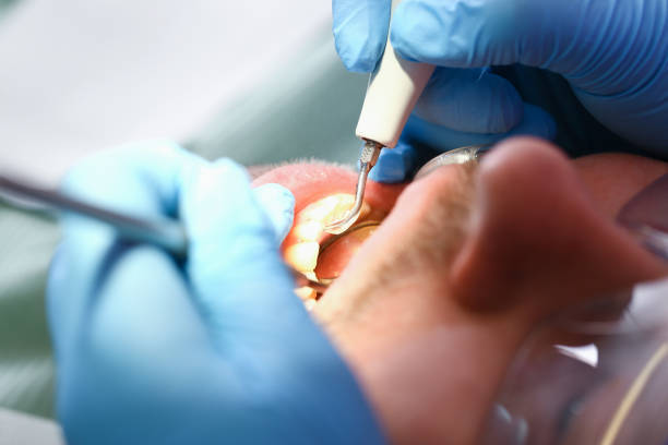 Best Walk-In Emergency Dental Services in Pittsboro, NC