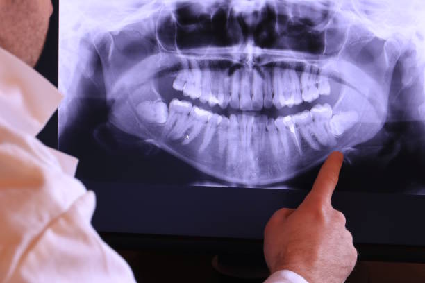 Best Broken or Chipped Tooth Repair in Pittsboro, NC